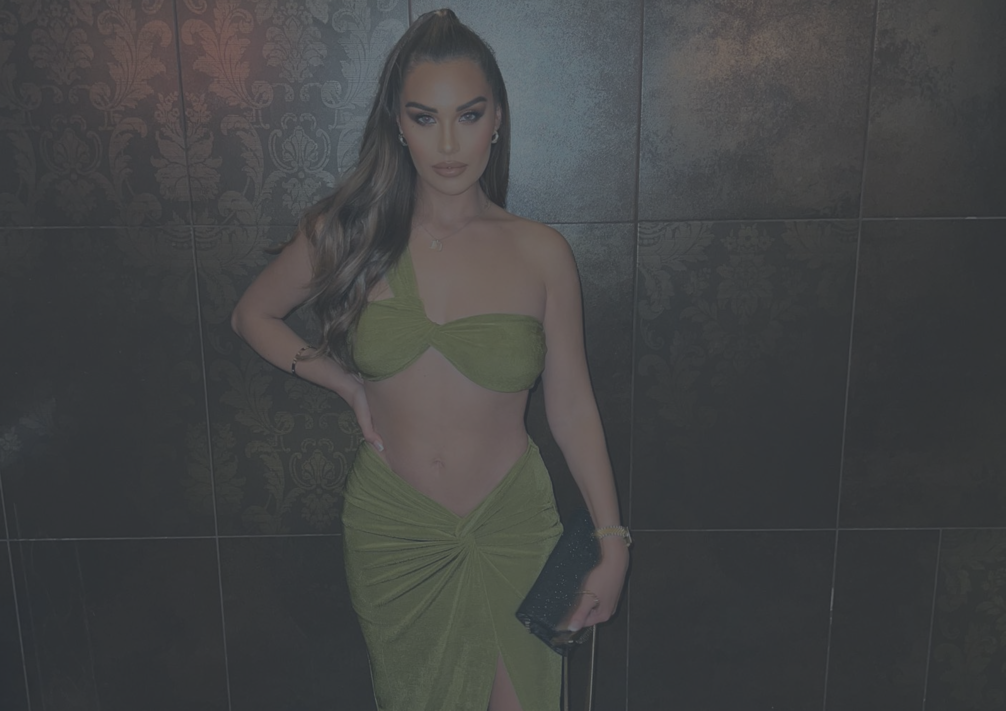 Liposuction Newton-le-Willows Liposuction Newton-le-Willows